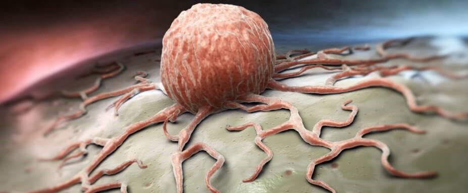 סוגי מחלות זיהומיות ומניעתן באמצעות CBD